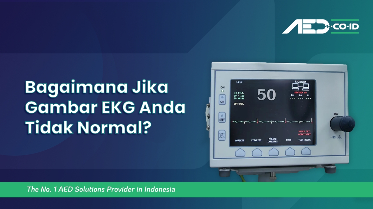 Bagaimana Jika Gambar EKG Anda Tidak Normal?