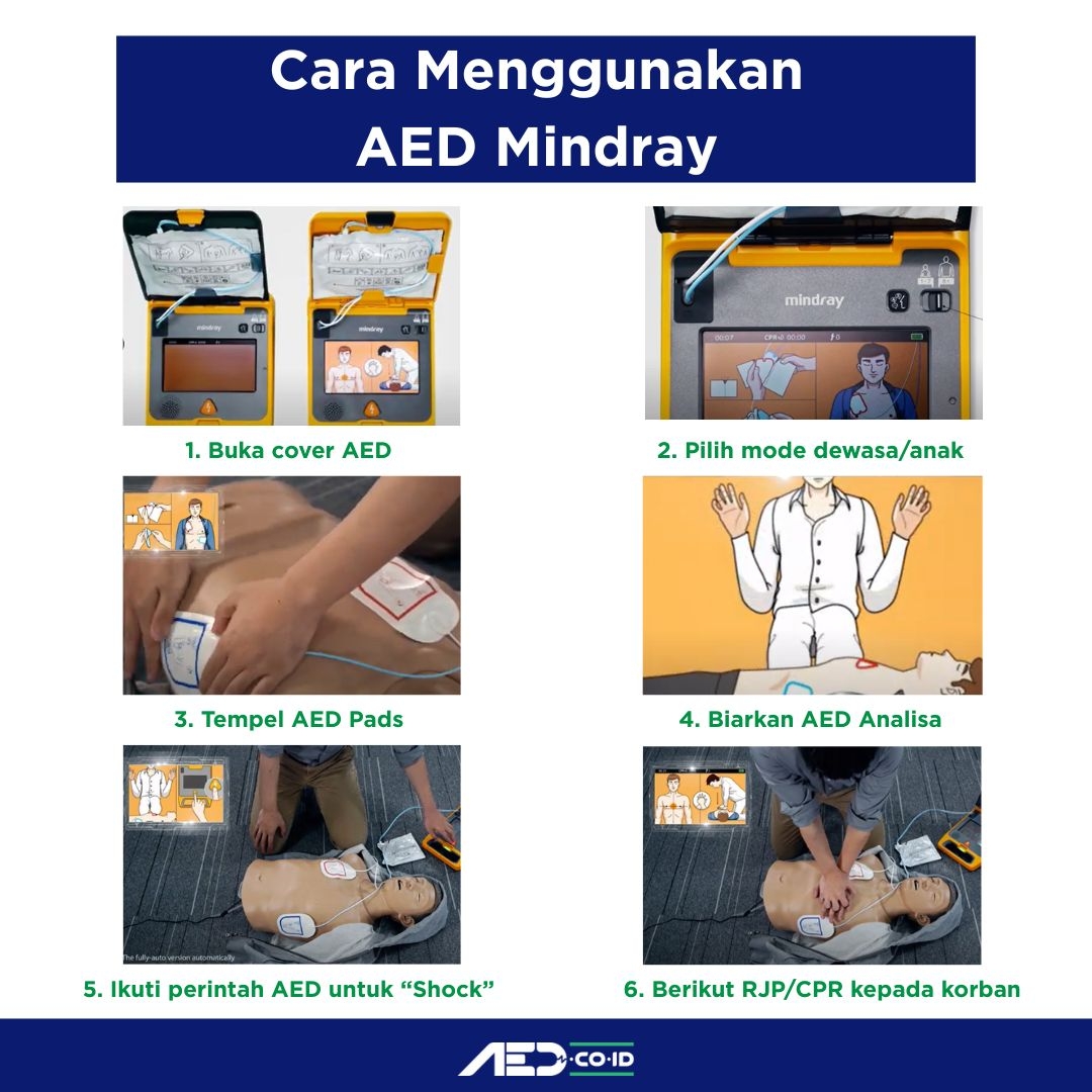 Flowchart Cara Menggunakan AED Mindray