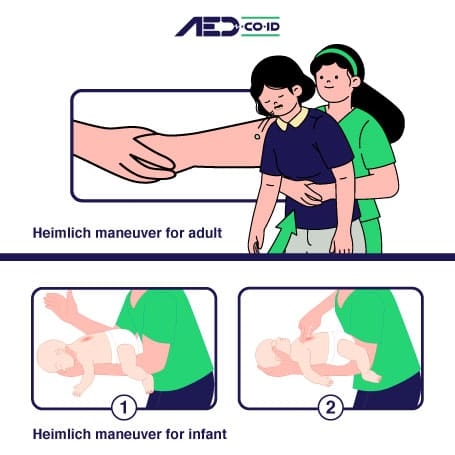 Heimlich Maneuver Untuk Dewasa Dan Bayi